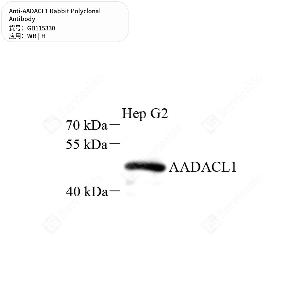 Антитела первичные, поликлональные кролика к AADACL1 человека, 50 мкл