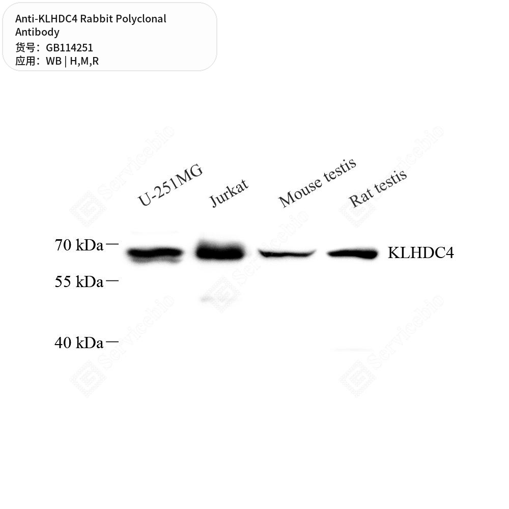 Антитела первичные, поликлональные кролика к KLHDC4 крысы, мыши, человека, 100 мкл
