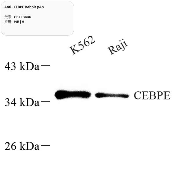 Антитела первичные, поликлональные, CEBPE, 100 мкл