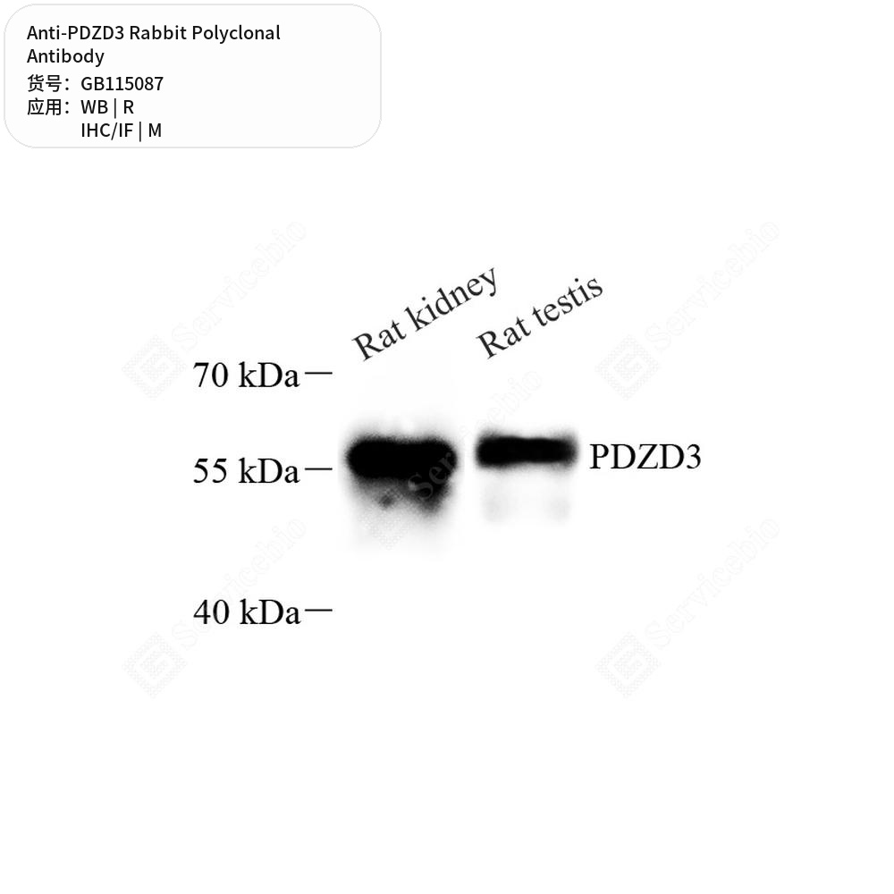 Антитела первичные, поликлональные кролика к PDZD3 крысы, мыши, 100 мкл