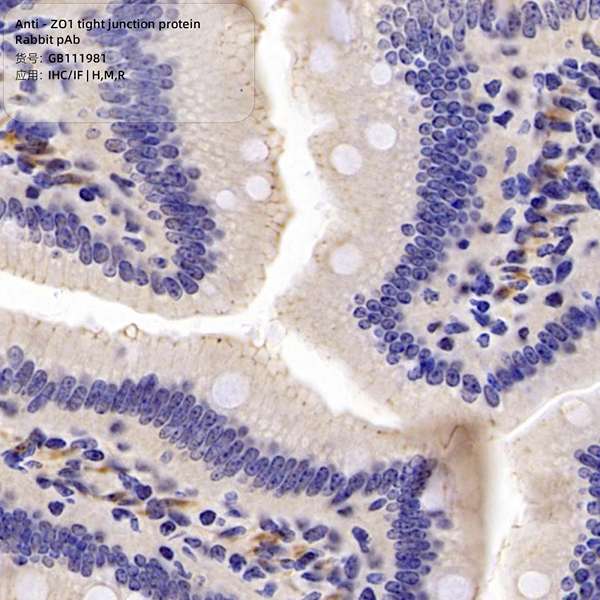 Антитела первичные, поликлональные, ZO1 tight junction protein, 100 мкл