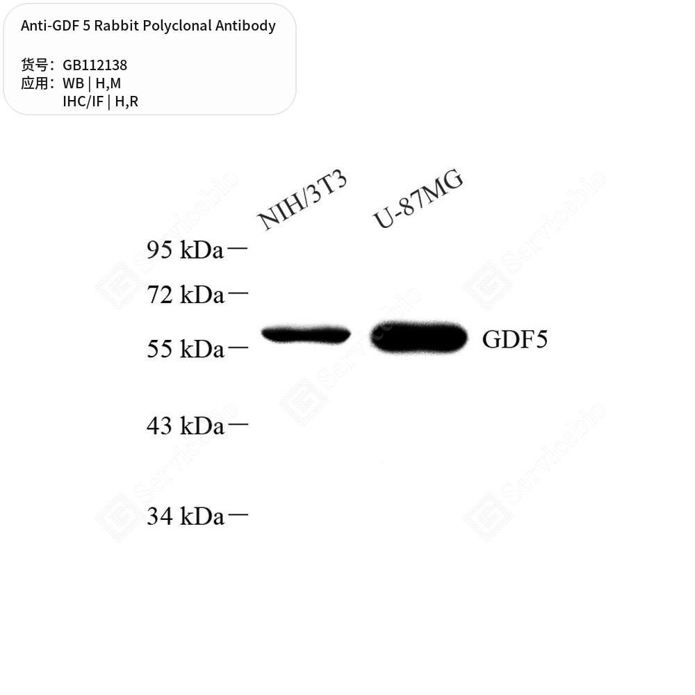 Антитела первичные, поликлональные кролика к GDF 5 крысы, мыши, человека, 100 мкл
