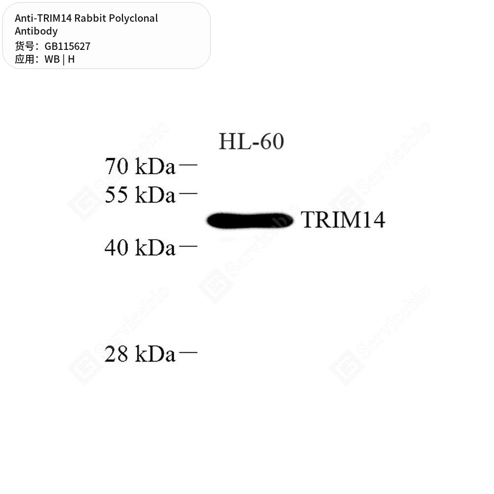 Антитела первичные, поликлональные кролика к TRIM14 человека, 50 мкл