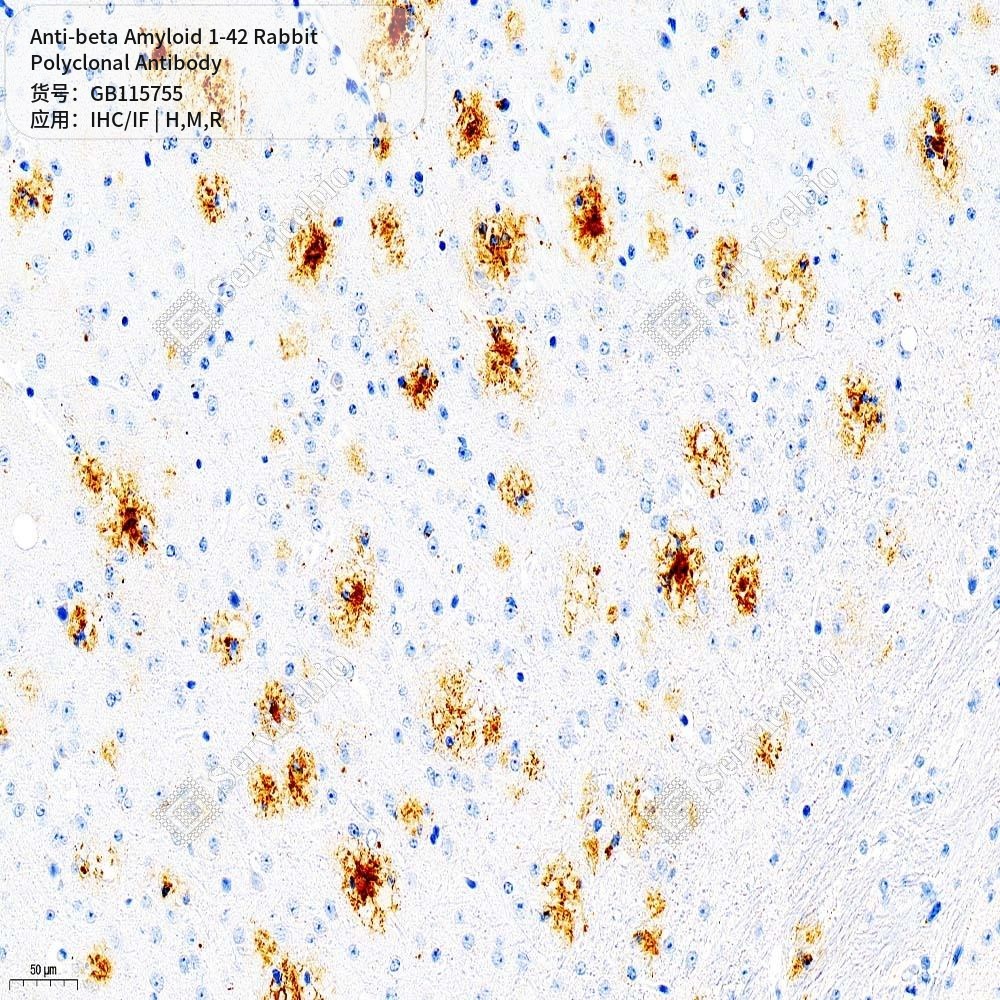 Антитела первичные, поликлональные кролика к beta Amyloid 1-42 крысы, мыши, человека, 50 мкл