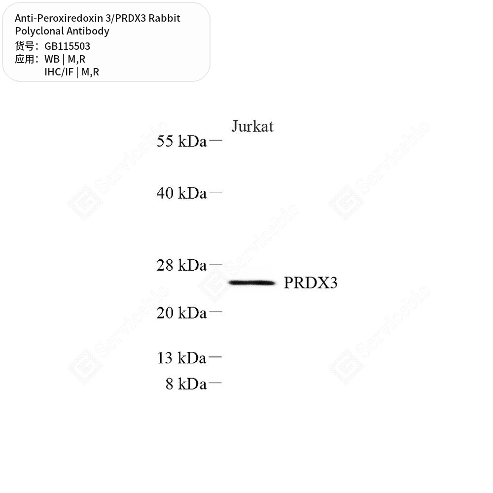 Антитела первичные, поликлональные кролика к Peroxiredoxin 3/PRDX3 крысы, мыши, 100 мкл