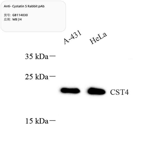 Антитела первичные, поликлональные, Cystatin S, 100 мкл