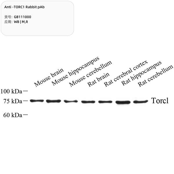 Антитела первичные, поликлональные, USP27X, 100 мкл