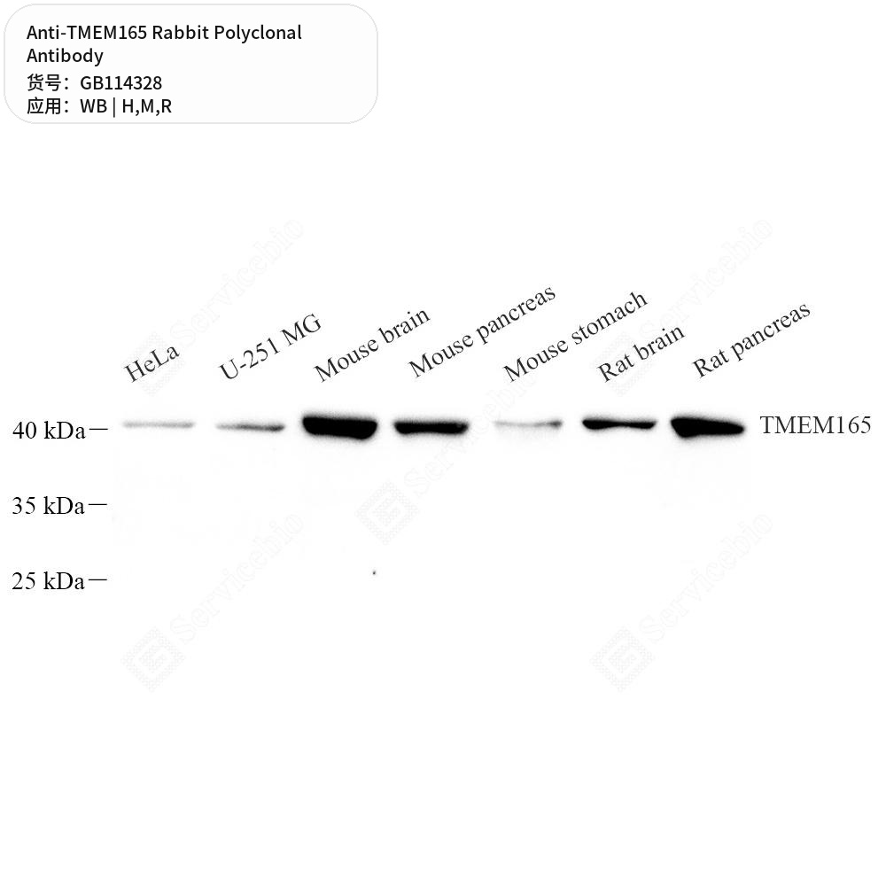 Антитела первичные, поликлональные кролика к TMEM165 крысы, мыши, человека, 100 мкл