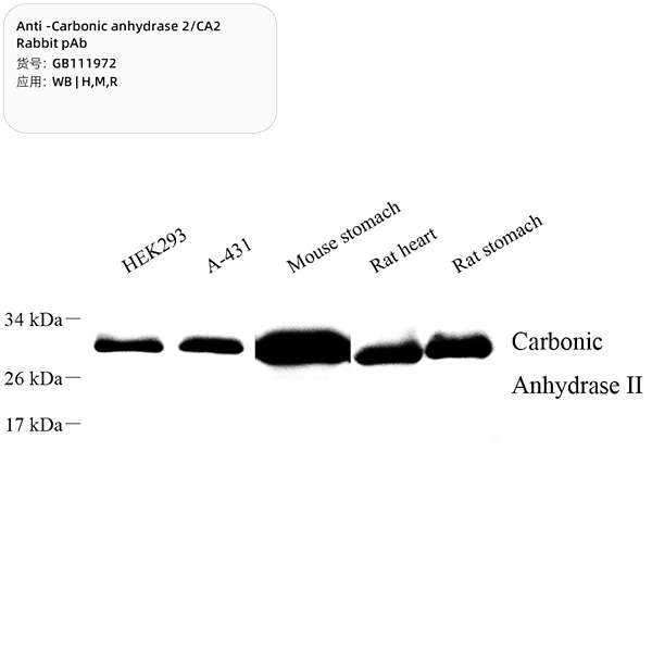 Антитела первичные, поликлональные, Carbonic anhydrase 2/CA2, 100 мкл