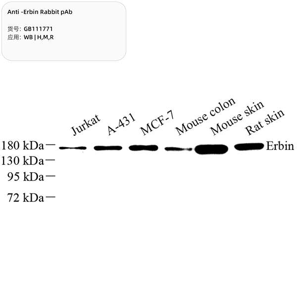 Антитела первичные, поликлональные, Erbin, 100 мкл