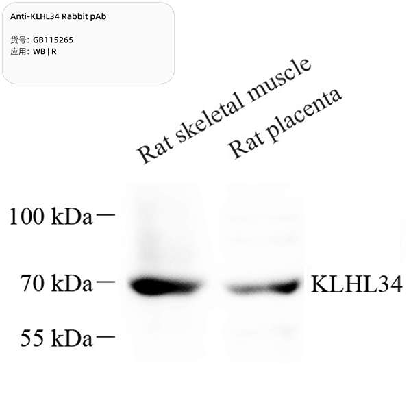 Антитела первичные, поликлональные, KLHL34, 100 мкл