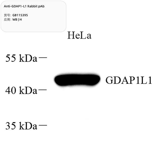 Антитела первичные, поликлональные, GDAP1-L1, 100 мкл