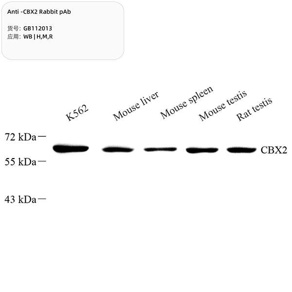Антитела первичные, поликлональные, CBX2, 100 мкл