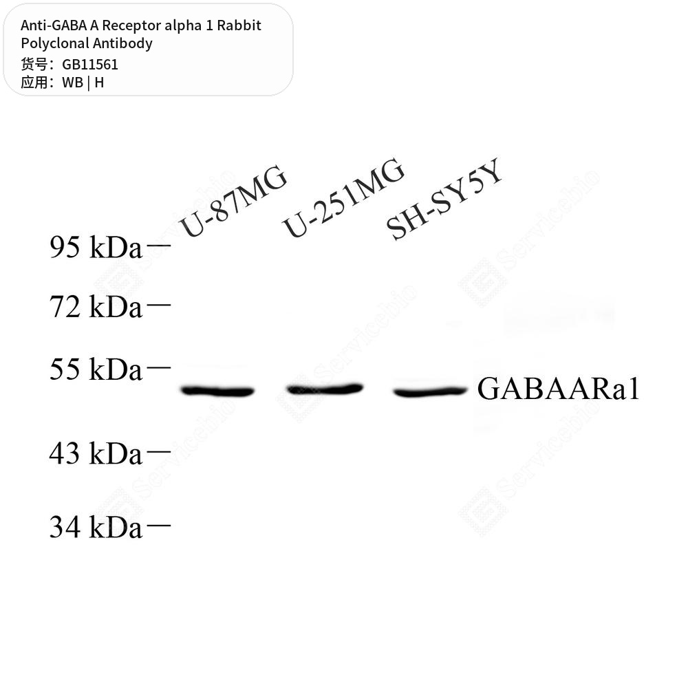 Антитела первичные, поликлональные кролика к GABA A Receptor alpha 1 человека, 50 мкл