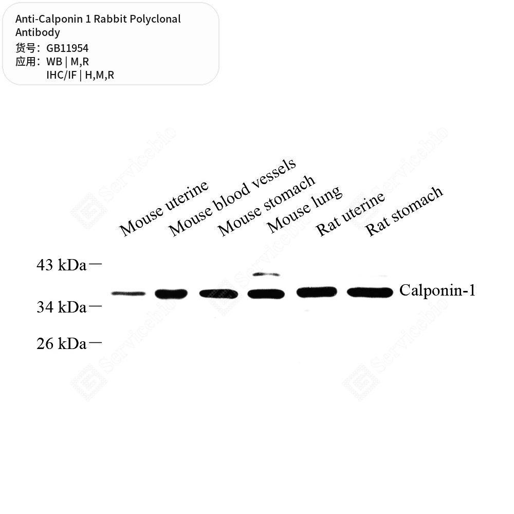 Антитела первичные, поликлональные кролика к Calponin 1 крысы, мыши, человека, 50 мкл