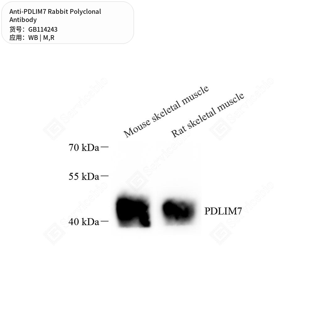 Антитела первичные, поликлональные кролика к PDLIM7 крысы, мыши, 100 мкл