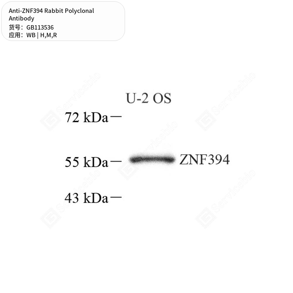 Антитела первичные, поликлональные кролика к ZNF394 крысы, мыши, человека, 100 мкл