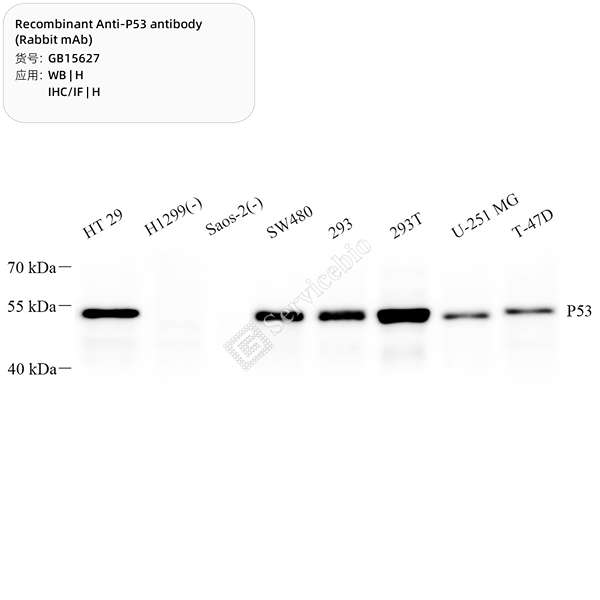 Антитела первичные, моноклональные, P53, 100 мкл