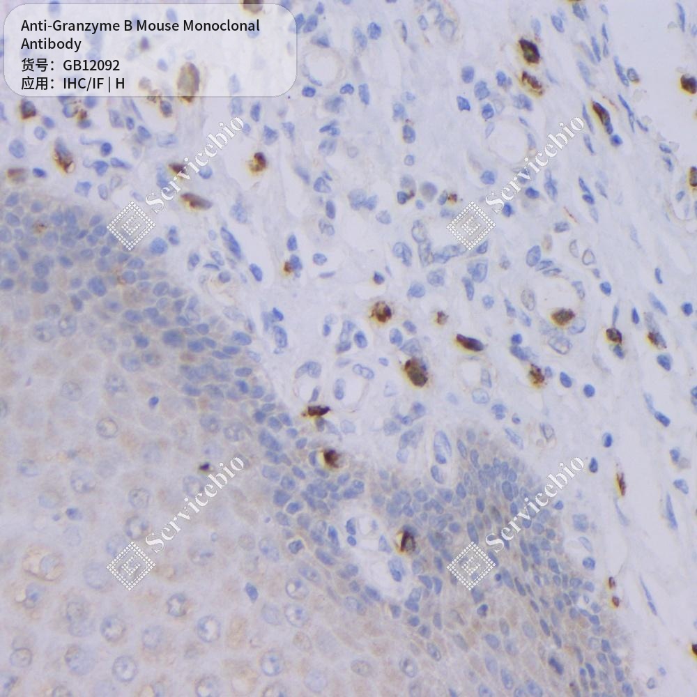 Антитела первичные, моноклональные мыши к Granzyme B человека, 50 мкл