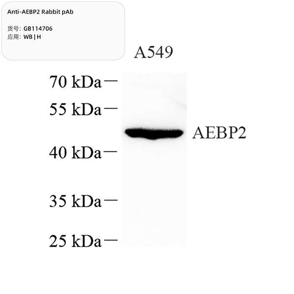 Антитела первичные, поликлональные, AEBP2, 100 мкл