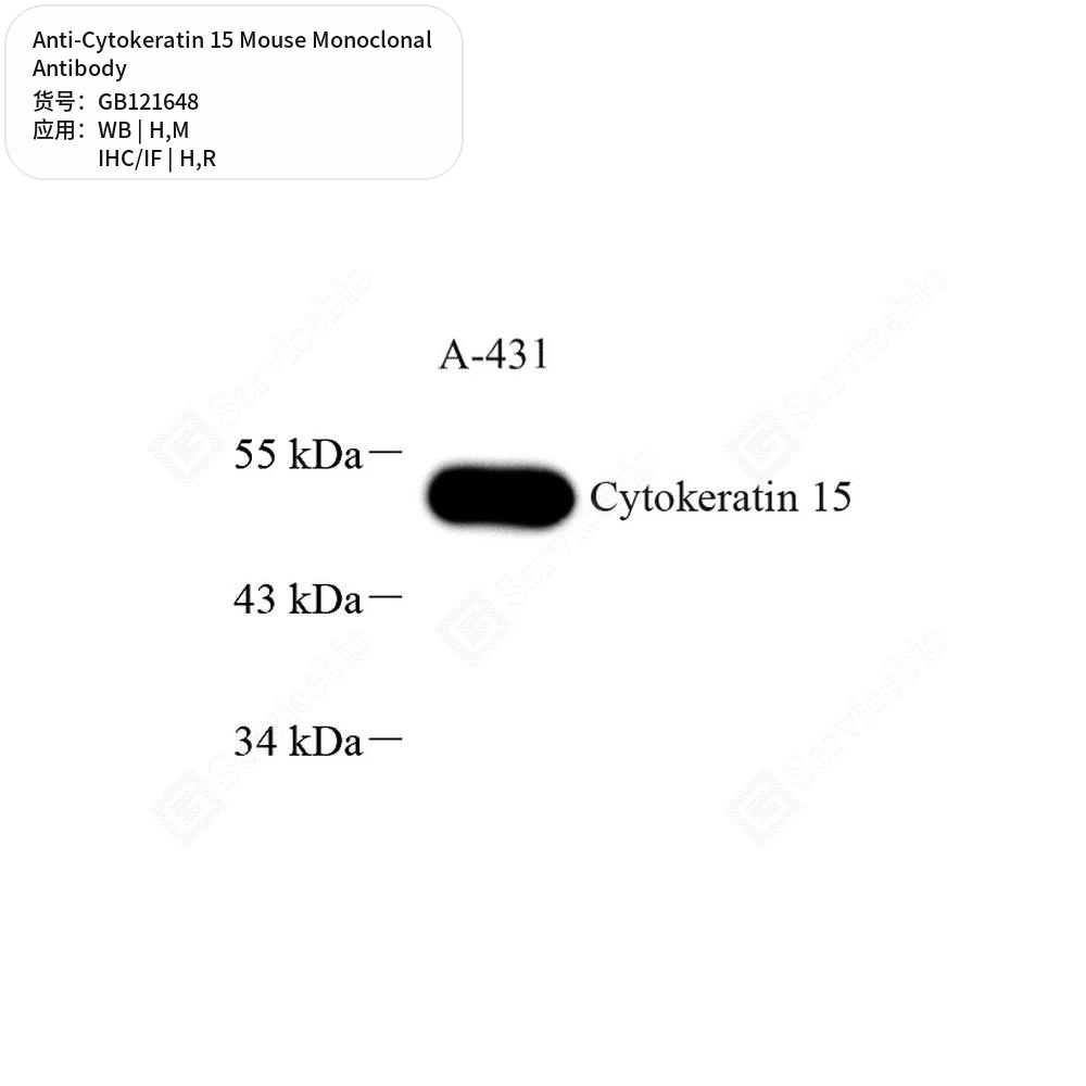 Антитела первичные, моноклональные мыши к Cytokeratin 15 крысы, мыши, человека, 100 мкл