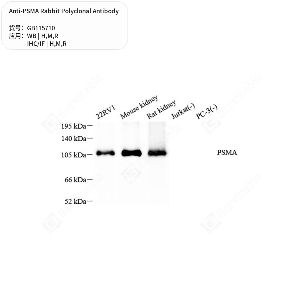 Антитела первичные, поликлональные кролика к PSMA крысы, мыши, человека, 50 мкл