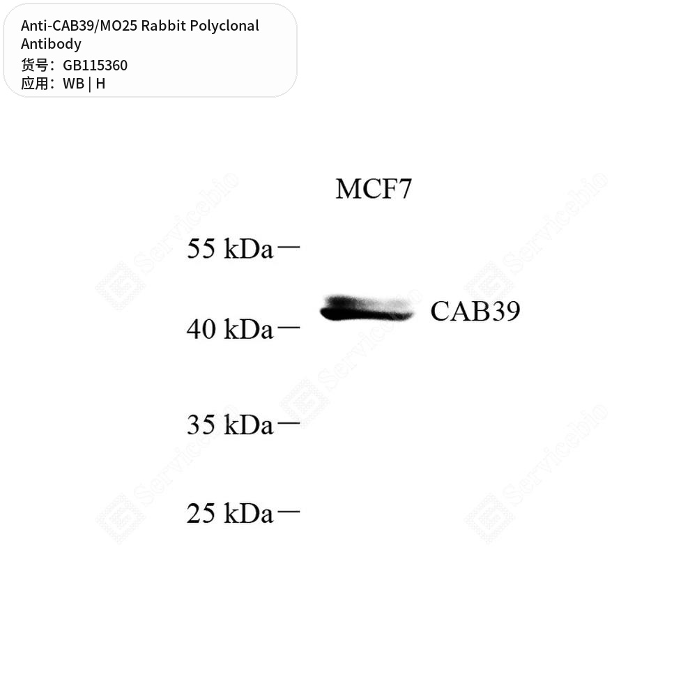 Антитела первичные, поликлональные кролика к CAB39/MO25 человека, 50 мкл
