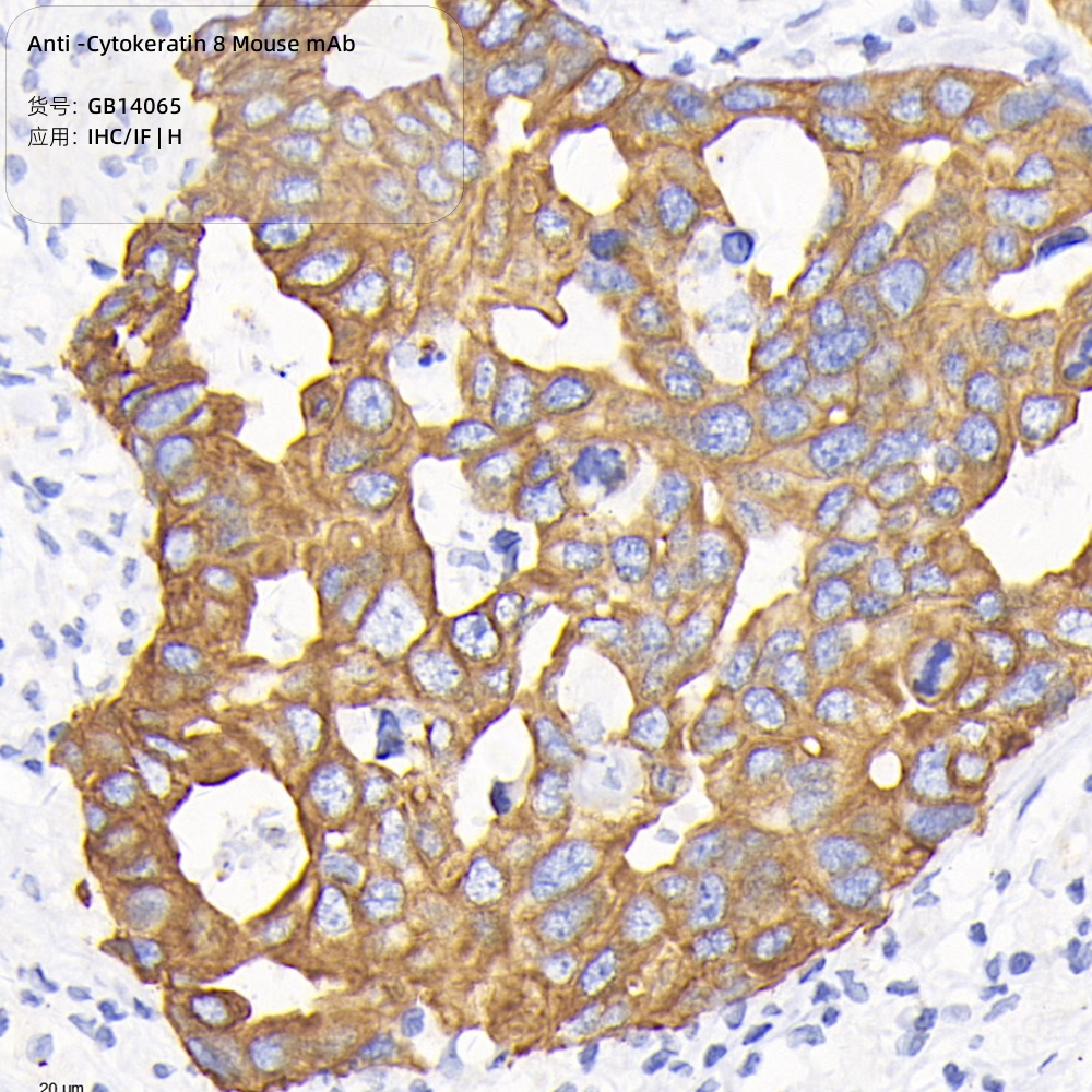 Антитела первичные, моноклональные мыши к Cytokeratin 8 человека, 50 мкл