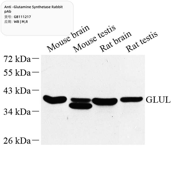 Антитела первичные, поликлональные, Glutamine Synthetase, 100 мкл