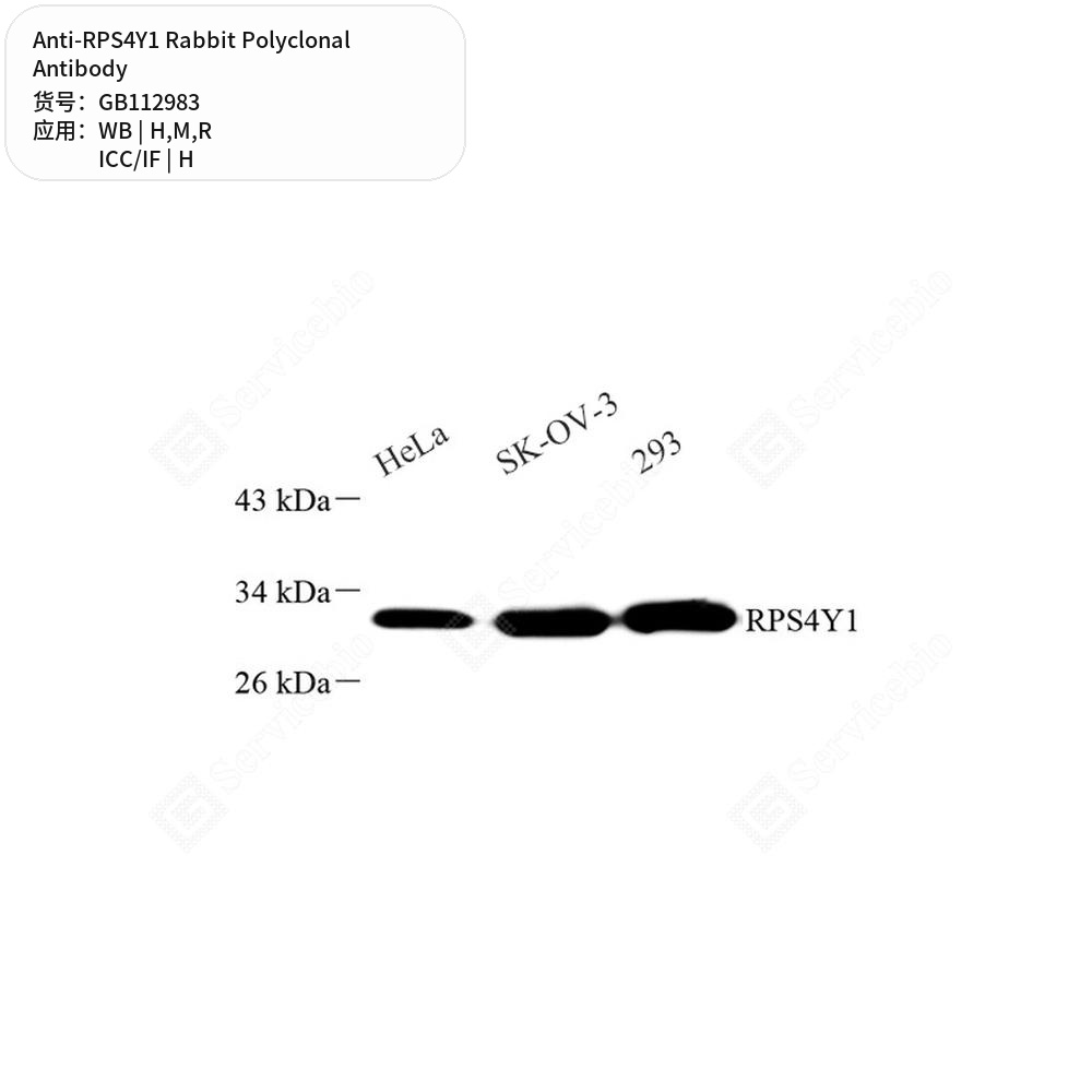 Антитела первичные, поликлональные кролика к RPS4Y1 крысы, мыши, человека, 100 мкл