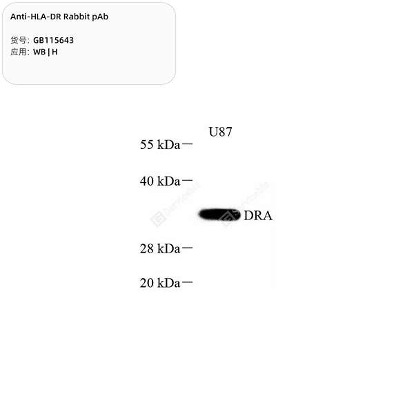 Антитела первичные, поликлональные, HLA-DR, 100 мкл