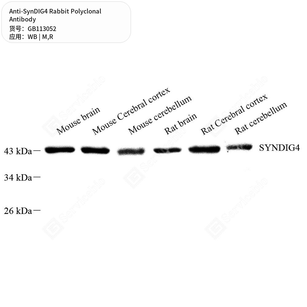 Антитела первичные, поликлональные кролика к SynDIG4 крысы, мыши, 50 мкл