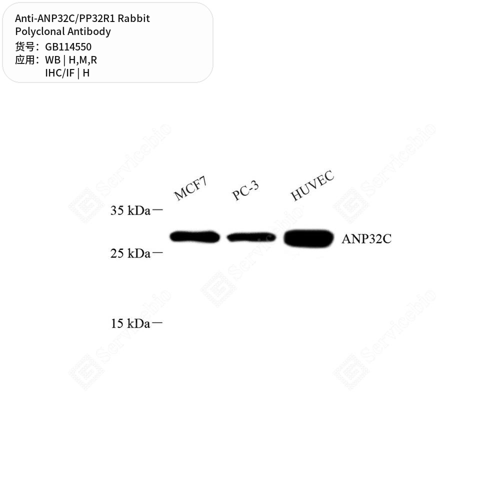Антитела первичные, поликлональные кролика к ANP32C/PP32R1 крысы, мыши, человека, 50 мкл