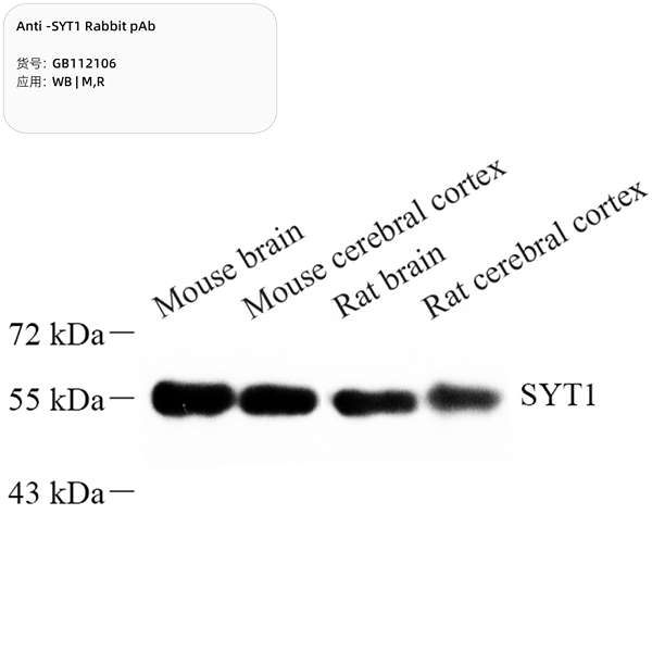 Антитела первичные, поликлональные, SYT1, 100 мкл