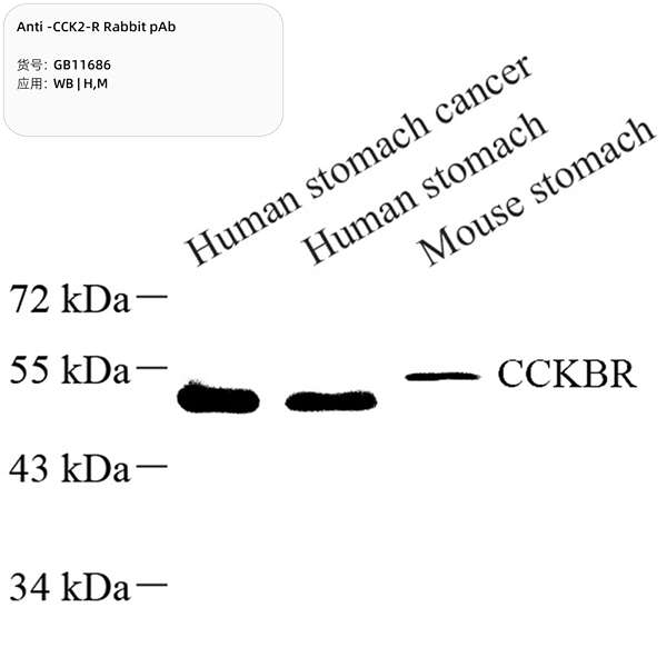 Антитела первичные, поликлональные, CCK2-R, 100 мкл
