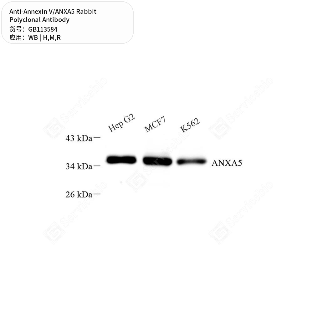 Антитела первичные, поликлональные кролика к Annexin V/ANXA5 крысы, мыши, человека, 50 мкл