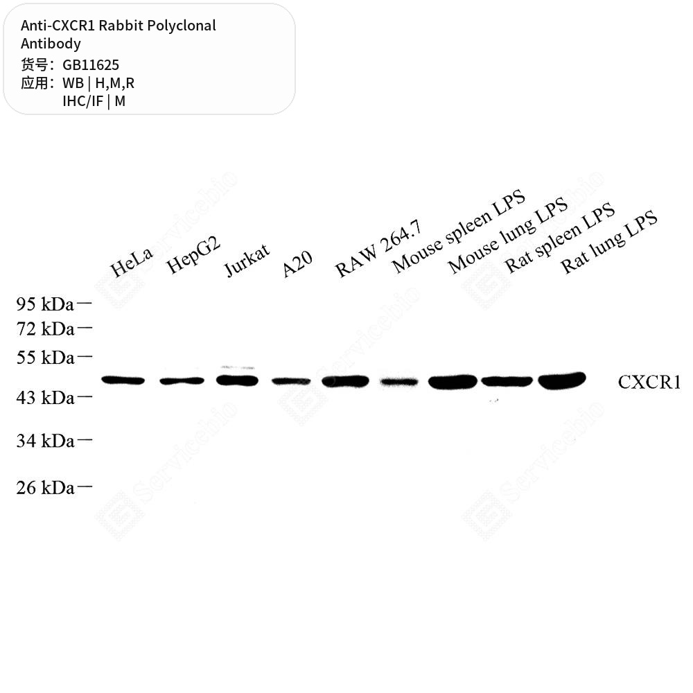 Антитела первичные, поликлональные кролика к CXCR1 крысы, мыши, человека, 50 мкл