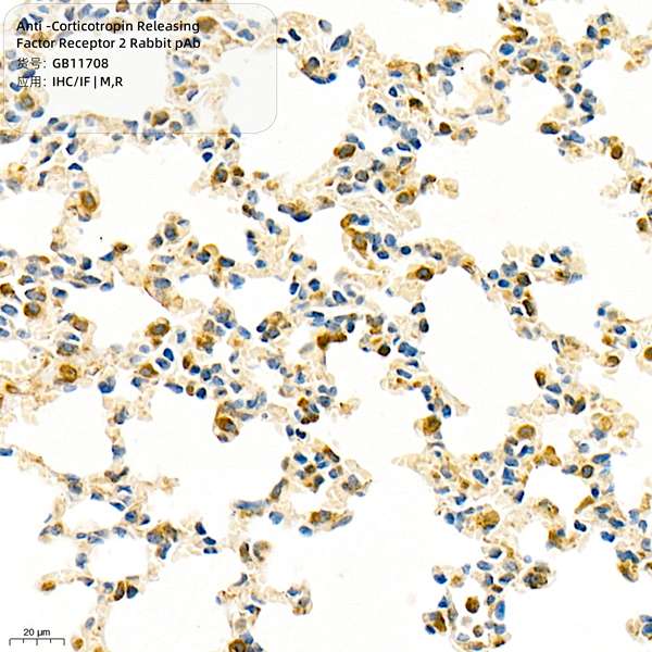 Антитела первичные, поликлональные, Corticotropin Releasing Factor Receptor 2, 100 мкл