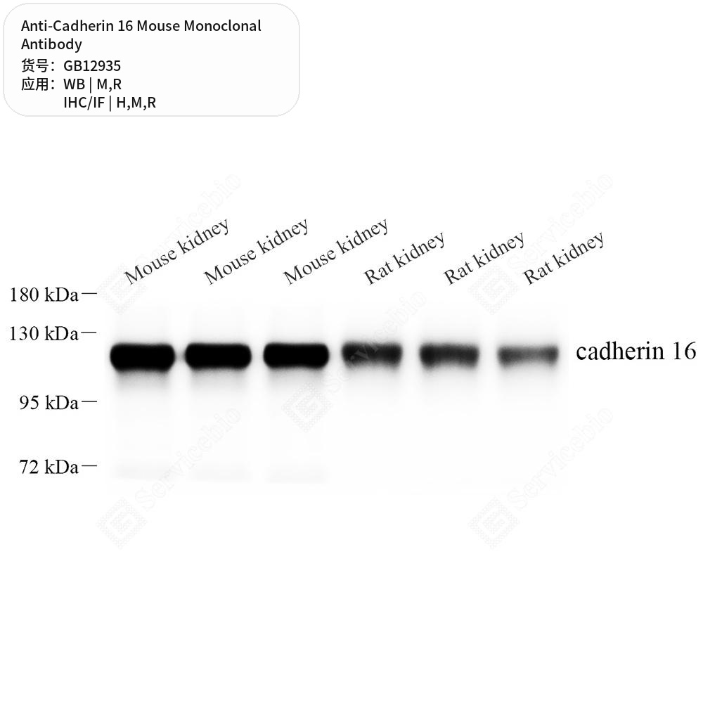 Антитела первичные, моноклональные мыши к Cadherin 16 крысы, мыши, человека, 50 мкл