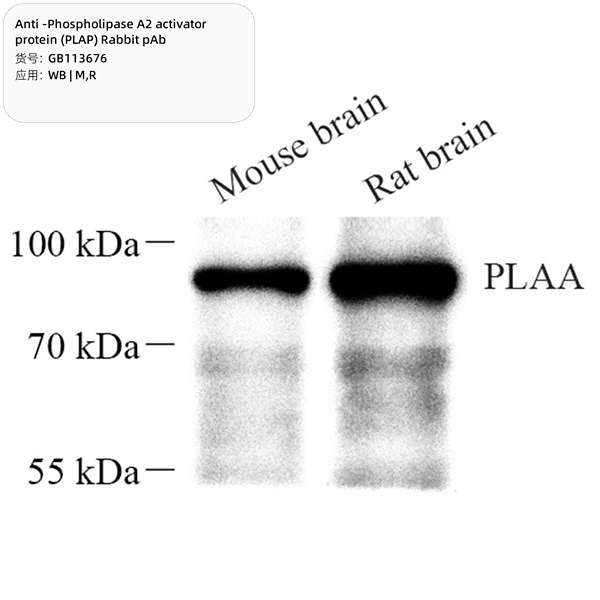 Антитела первичные, поликлональные, Phospholipase A2 activator protein (PLAP), 100 мкл