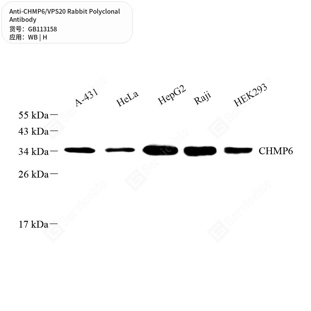 Антитела первичные, поликлональные кролика к CHMP6/VPS20 человека, 100 мкл