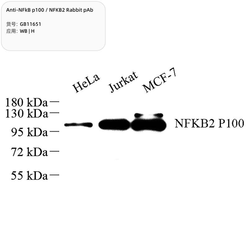 Антитела первичные, поликлональные, NFkB p100/p52, 100 мкл
