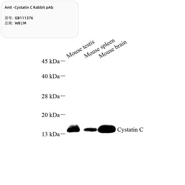 Антитела первичные, поликлональные, Cystatin C, 100 мкл