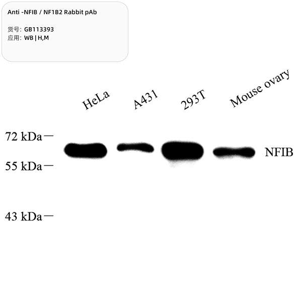 Антитела первичные, поликлональные, NFIB/NF1B2, 100 мкл