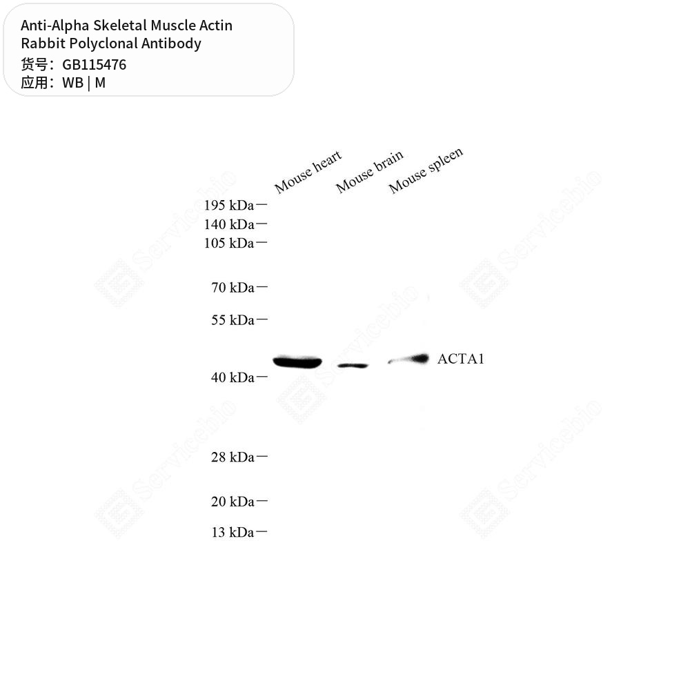 Антитела первичные, поликлональные кролика к Alpha Skeletal Muscle Actin мыши, 50 мкл