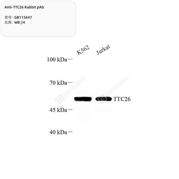 Антитела первичные, поликлональные, TTC26, 100 мкл