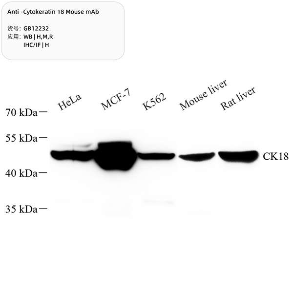 Антитела первичные, моноклональные, Cytokeratin 18, 100 мкл