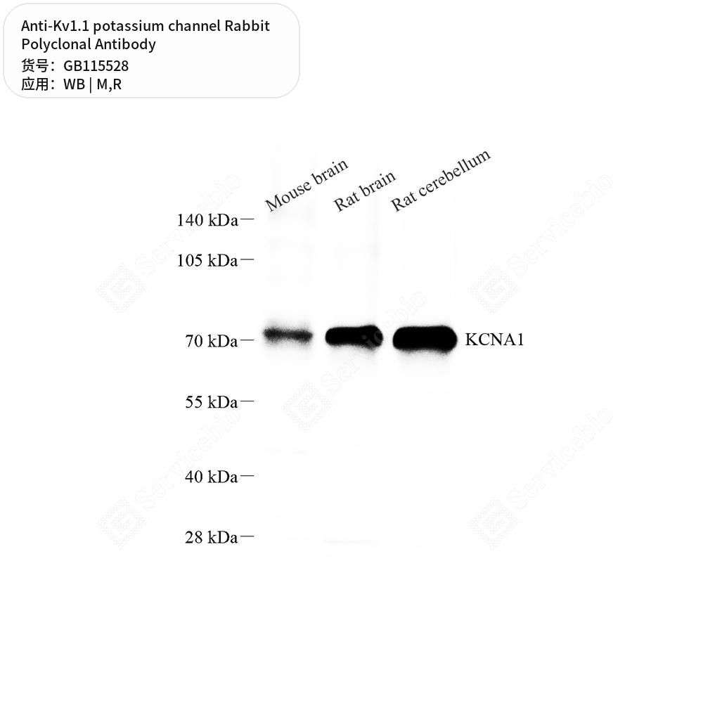 Антитела первичные, поликлональные кролика к Kv1.1 potassium channel крысы, мыши, 50 мкл