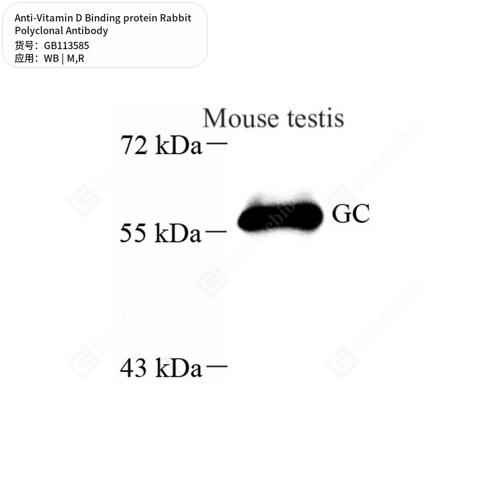 Антитела первичные, поликлональные кролика к Vitamin D Binding protein крысы, мыши, 50 мкл