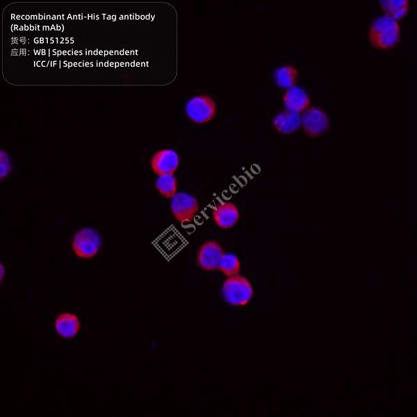 Антитела первичные, моноклональные, His Tag, 100 мкл